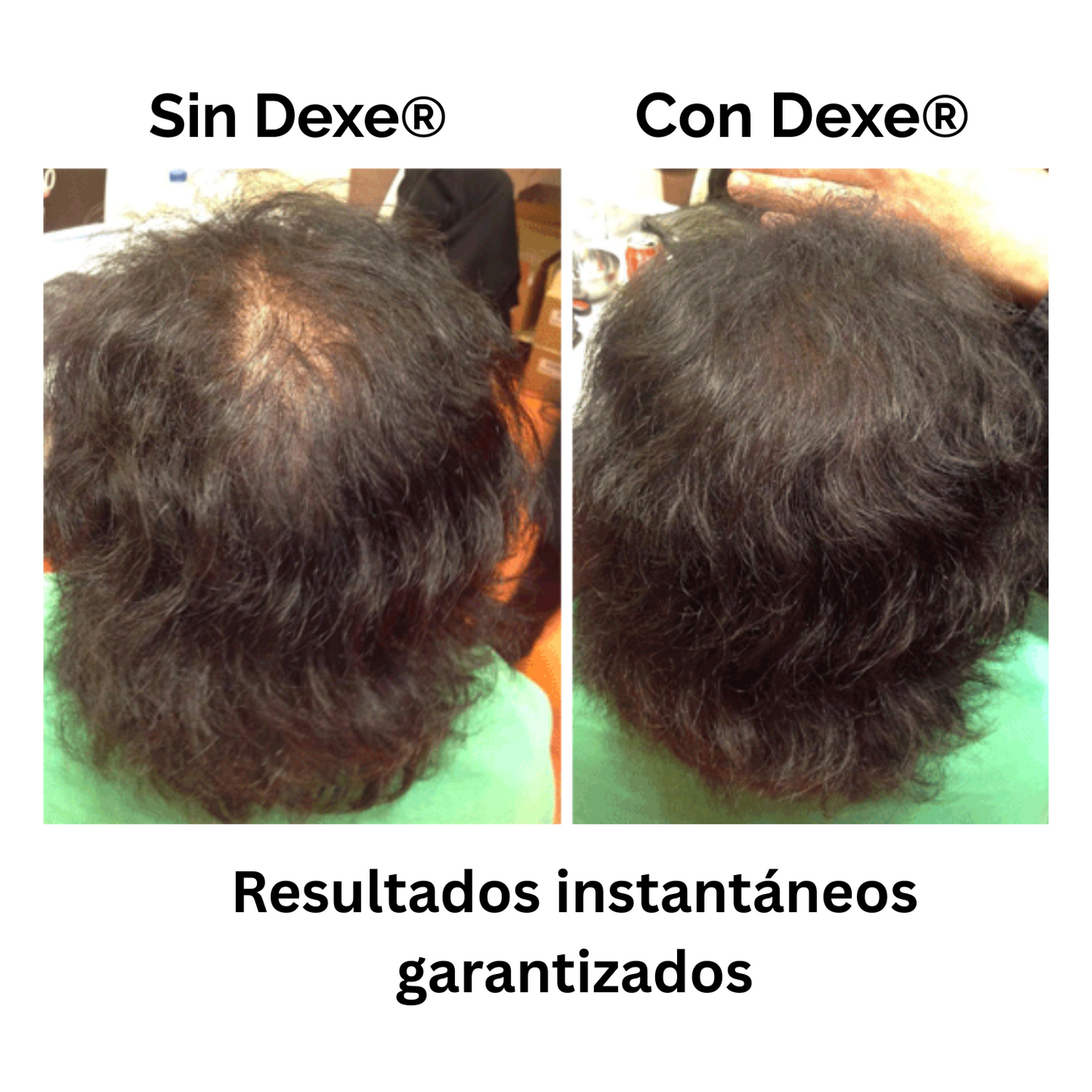 FIBRA CAPILAR DEXE®  ¡CUBRE TU CALVICIE EN SEGUNDOS!